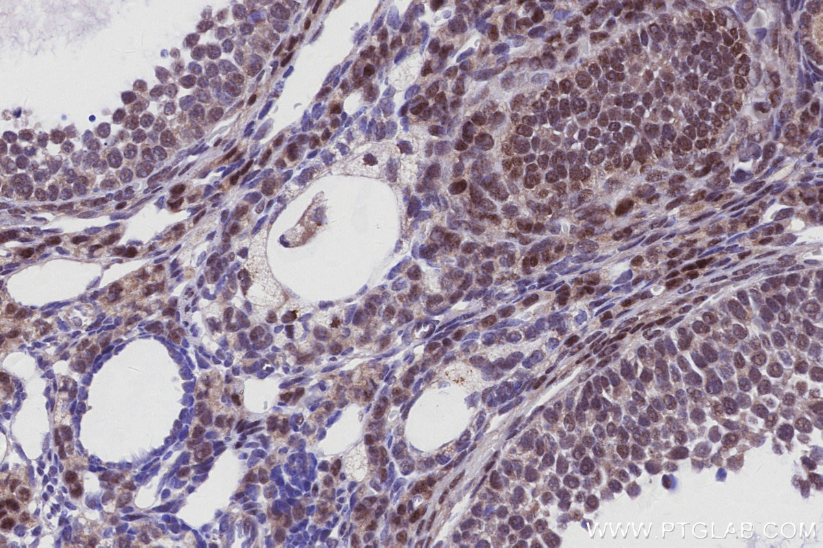 Immunohistochemistry (IHC) staining of mouse ovary tissue using MKNK2 Recombinant monoclonal antibody (83235-1-RR)