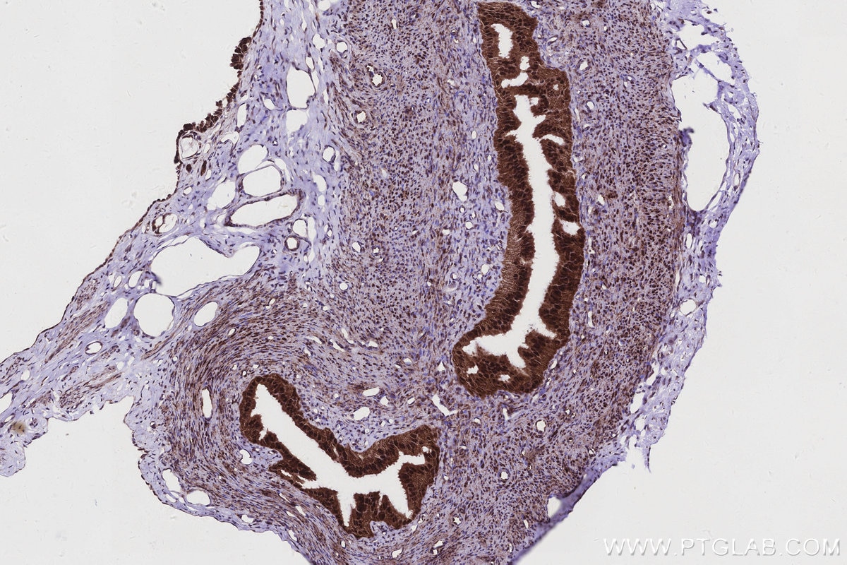 Immunohistochemistry (IHC) staining of rat ovary tissue using MKNK2 Recombinant monoclonal antibody (83235-1-RR)