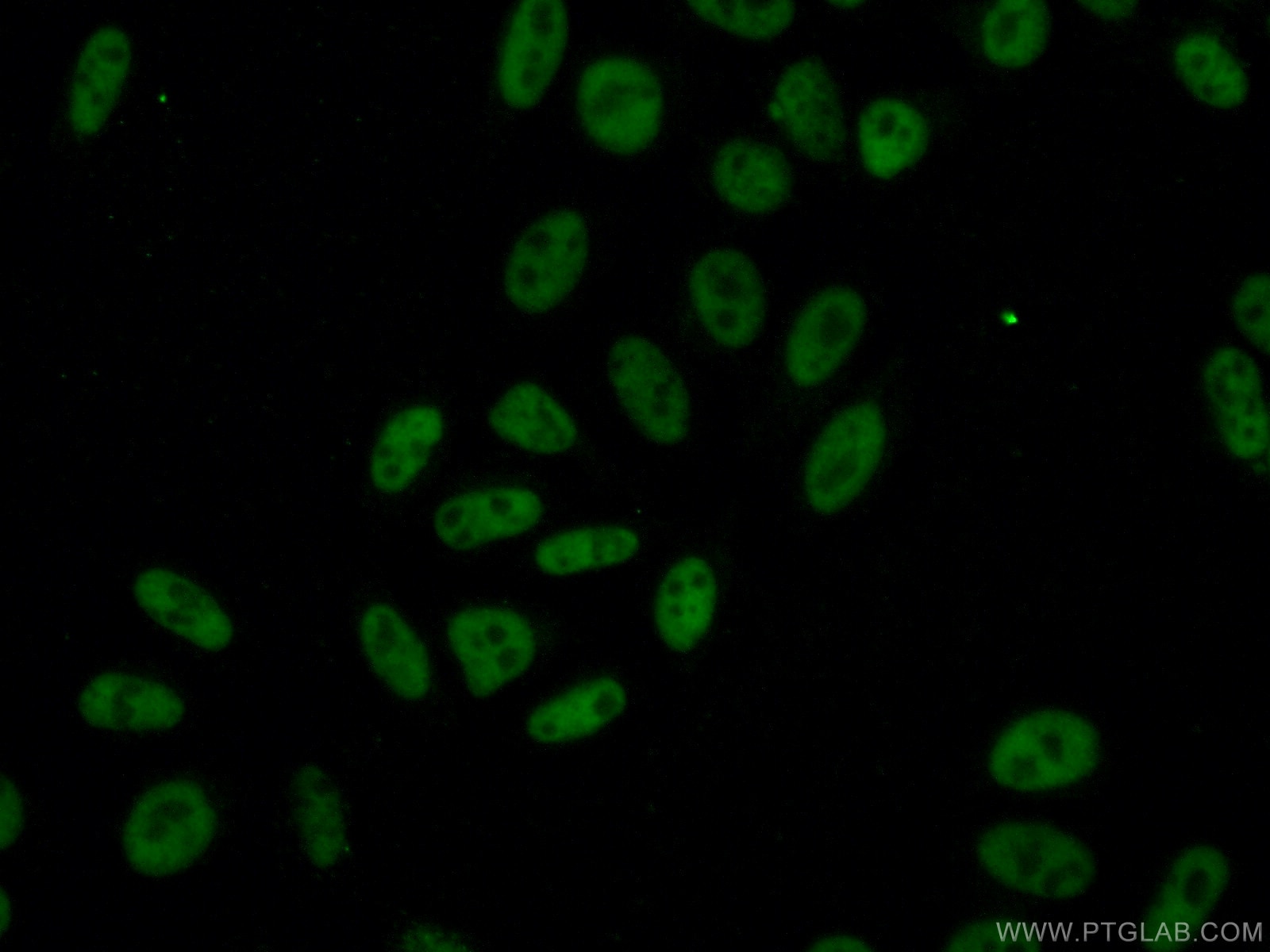 Immunofluorescence (IF) / fluorescent staining of HepG2 cells using MKP-2 Monoclonal antibody (66349-1-Ig)