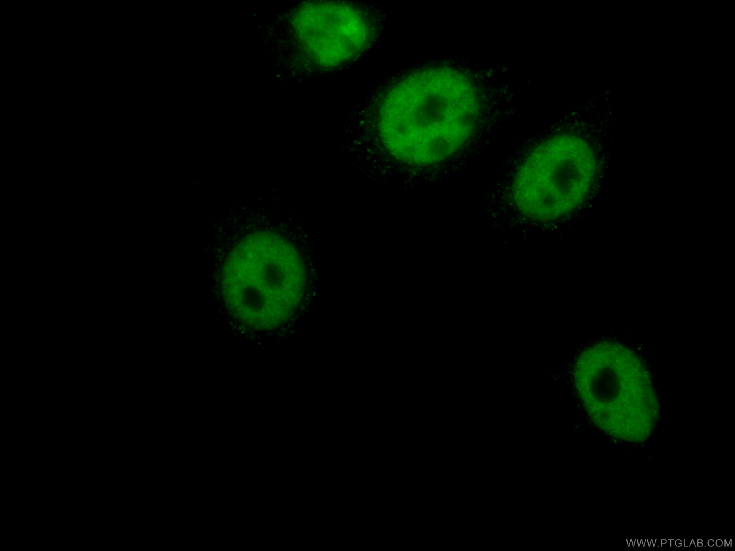 Immunofluorescence (IF) / fluorescent staining of HepG2 cells using CoraLite® Plus 488-conjugated MKP-2 Monoclonal ant (CL488-66349)