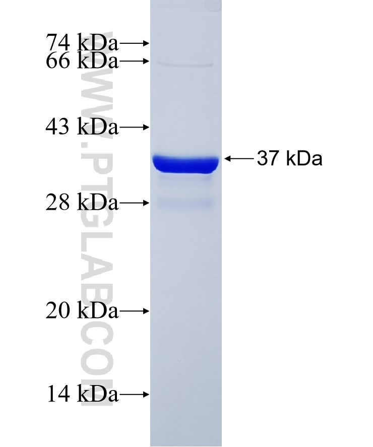 MKP-2 fusion protein Ag26446 SDS-PAGE