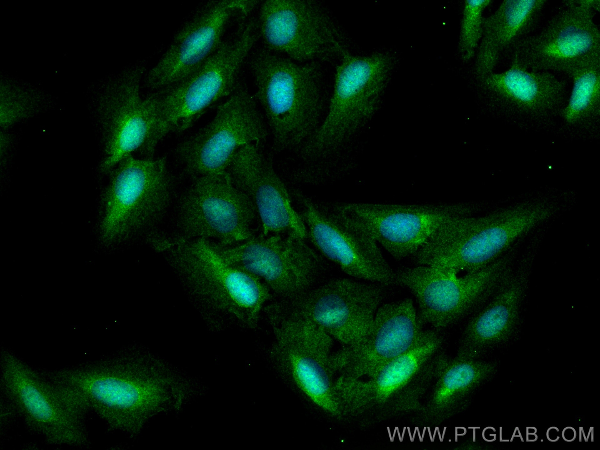 Immunofluorescence (IF) / fluorescent staining of U2OS cells using MKRN2 Polyclonal antibody (12238-1-AP)