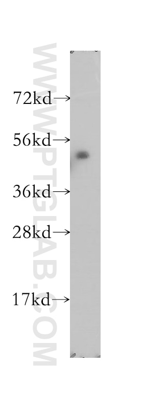 Western Blot (WB) analysis of A375 cells using MKRN2 Polyclonal antibody (12238-1-AP)