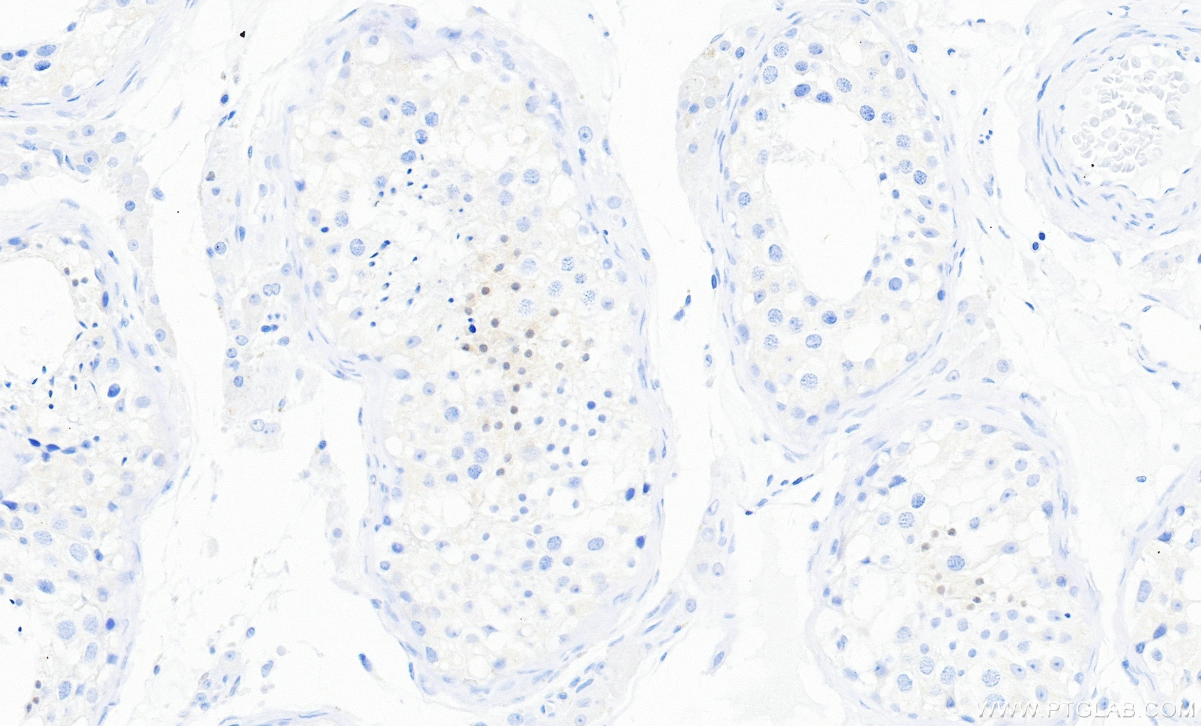Immunohistochemistry (IHC) staining of human testis tissue using MKRN2 Recombinant monoclonal antibody (87026-1-RR)