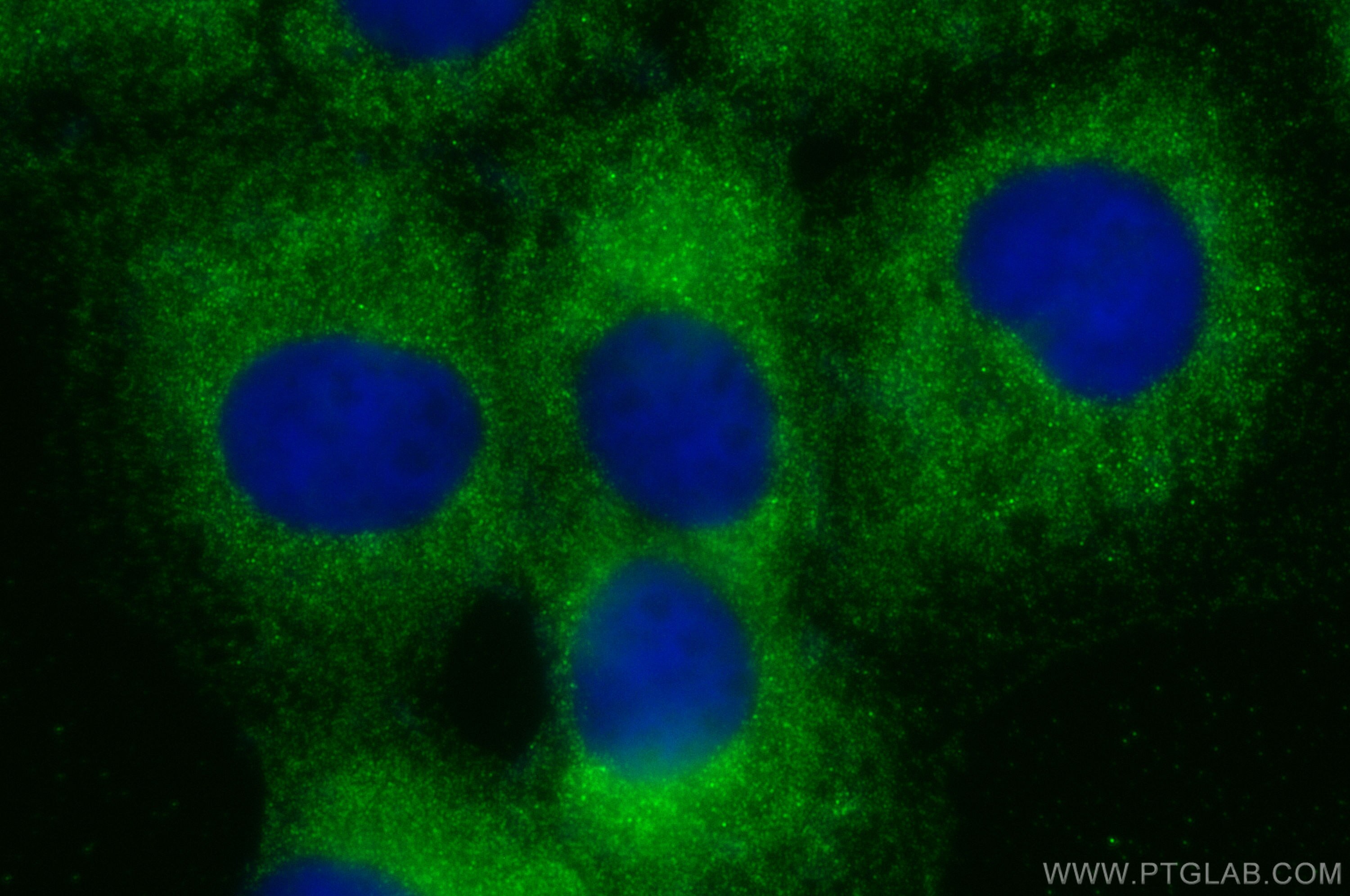 IF Staining of A431 using 18349-1-AP