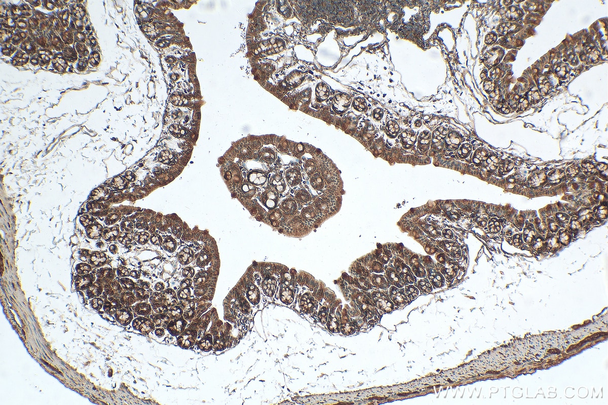 IHC staining of mouse colon using 18349-1-AP