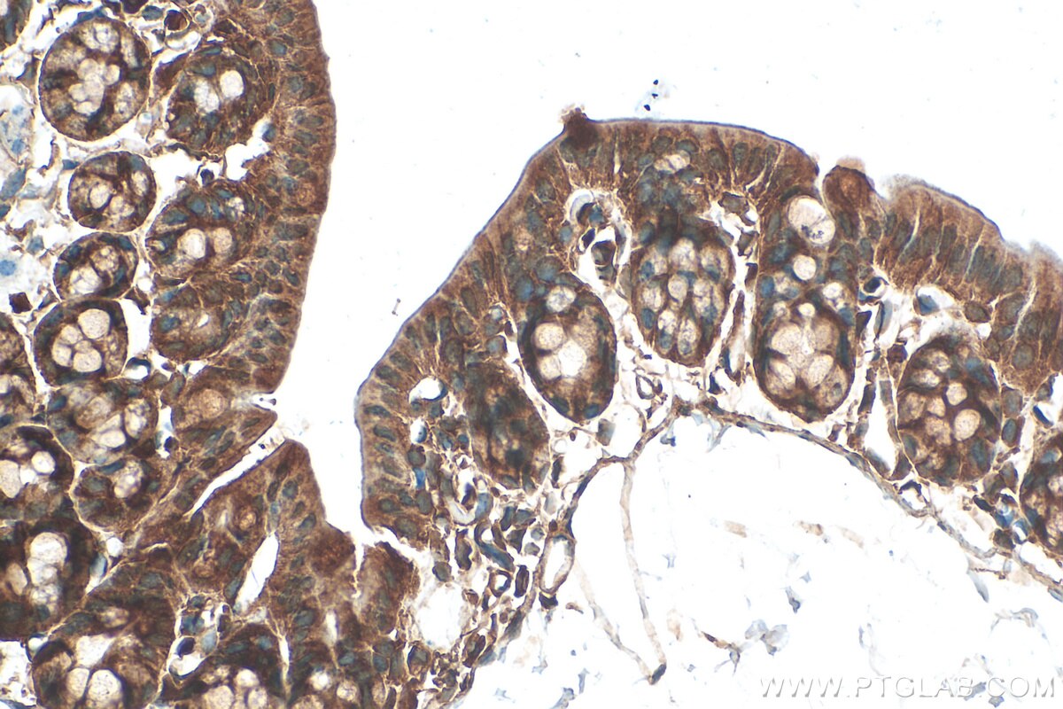 Immunohistochemistry (IHC) staining of mouse colon tissue using MKRN3 Polyclonal antibody (18349-1-AP)