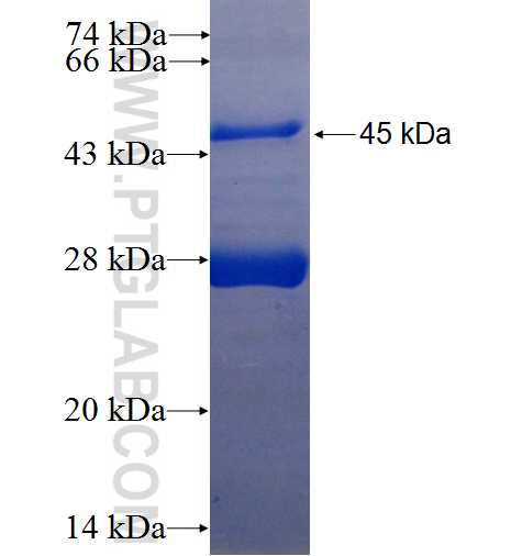 MKX fusion protein Ag25549 SDS-PAGE