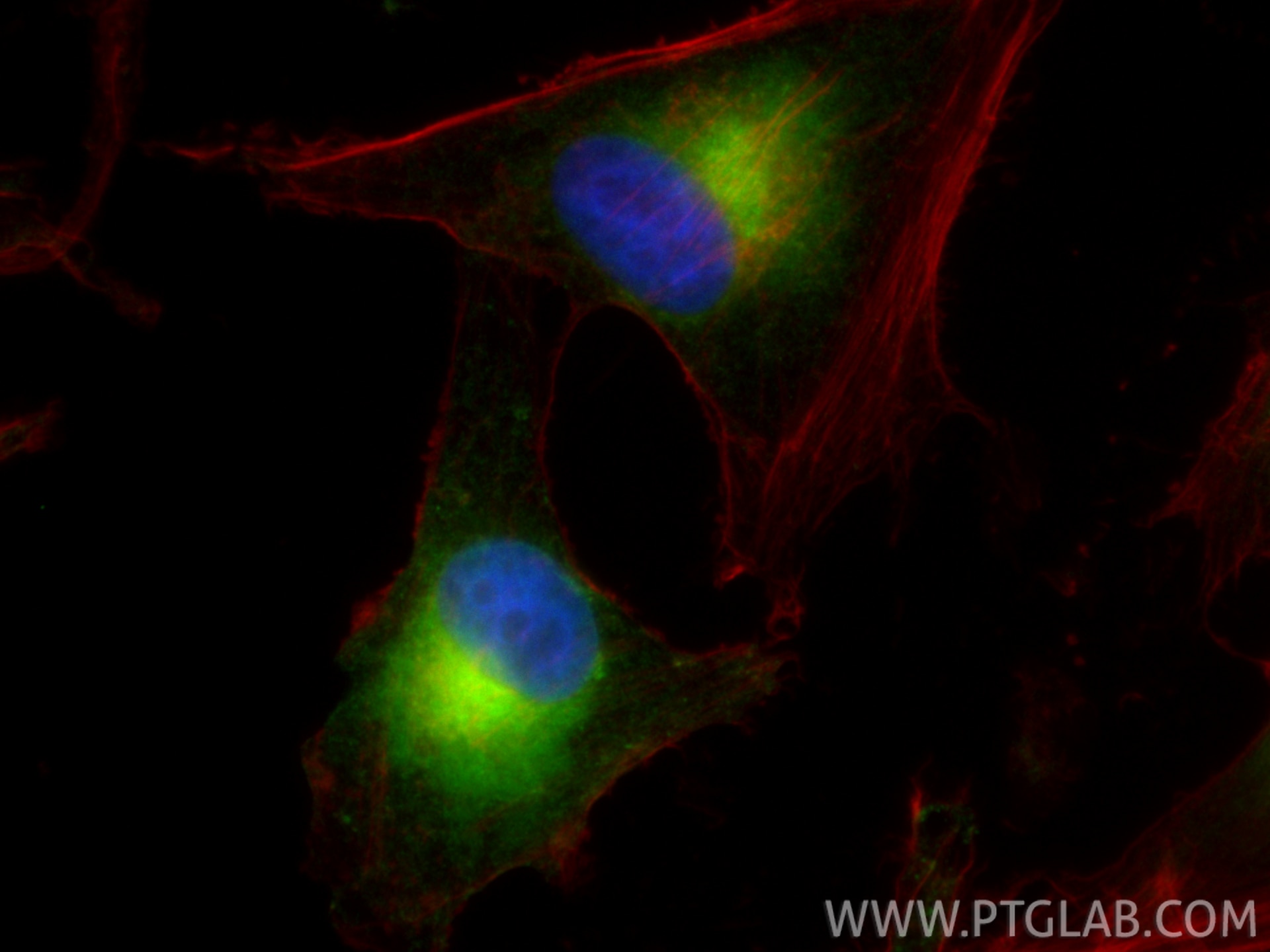 IF Staining of SK-MEL-28 using 18472-1-AP Immunofluorescence (IF) / fluorescent staining of SK-MEL-28 cells using Melan-A Polyclonal antibody (18472-1-AP)