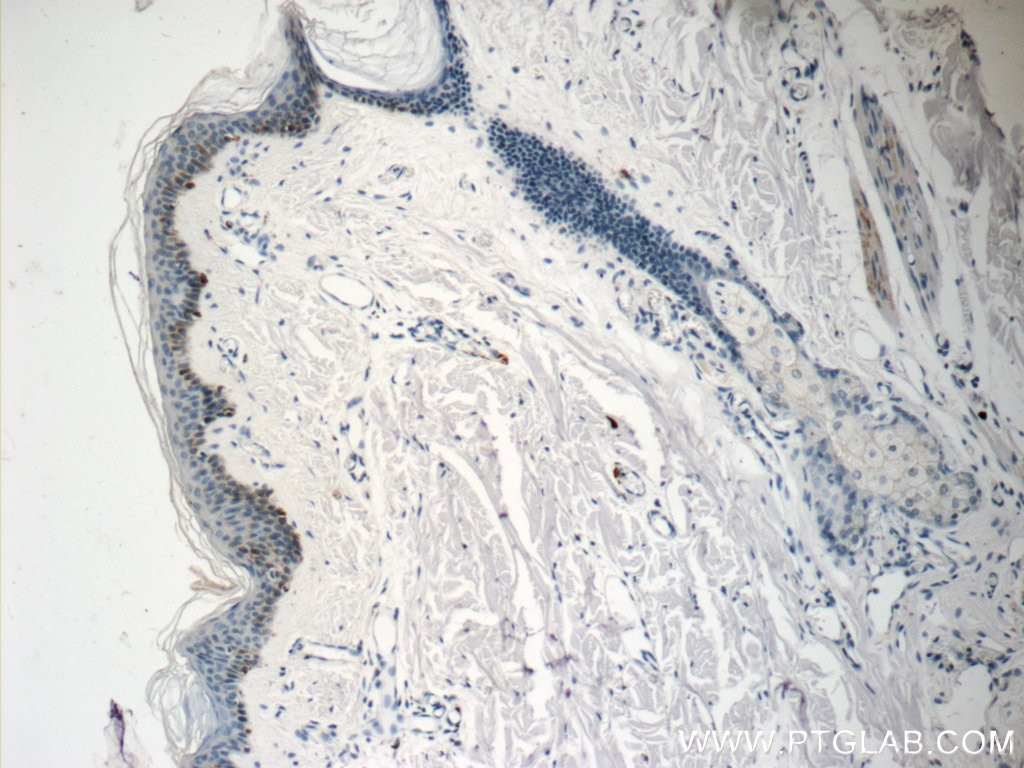 Immunohistochemistry (IHC) staining of human skin tissue using Melan-A Polyclonal antibody (18472-1-AP)