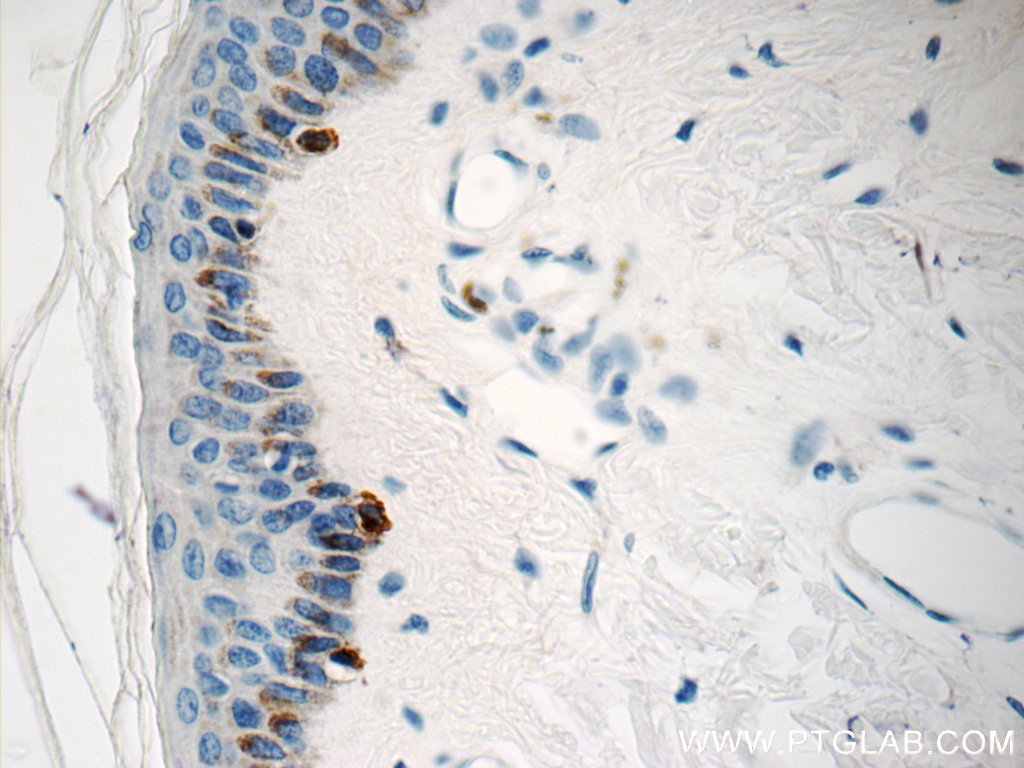 IHC staining of human skin using 18472-1-AP