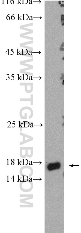 Western Blot (WB) analysis of mouse eye tissue using Melan-A Polyclonal antibody (18472-1-AP)