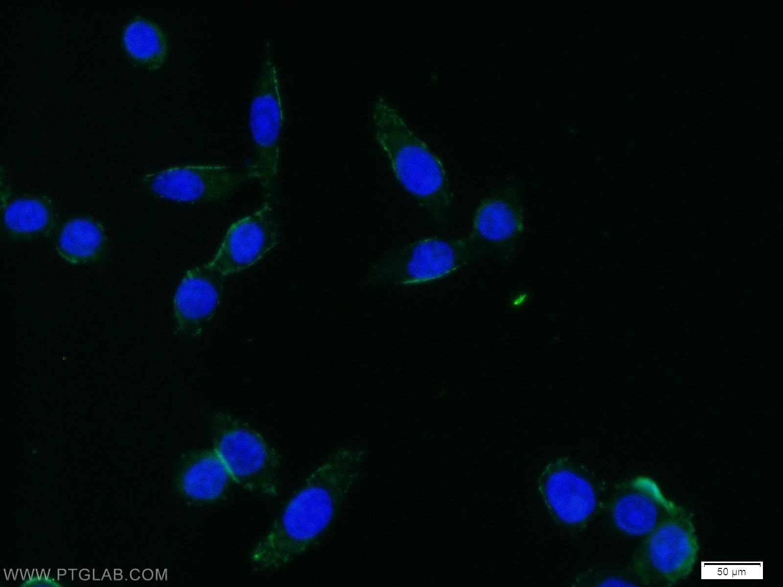 Immunofluorescence (IF) / fluorescent staining of BxPC-3 cells using MLC1 Polyclonal antibody (12183-1-AP)