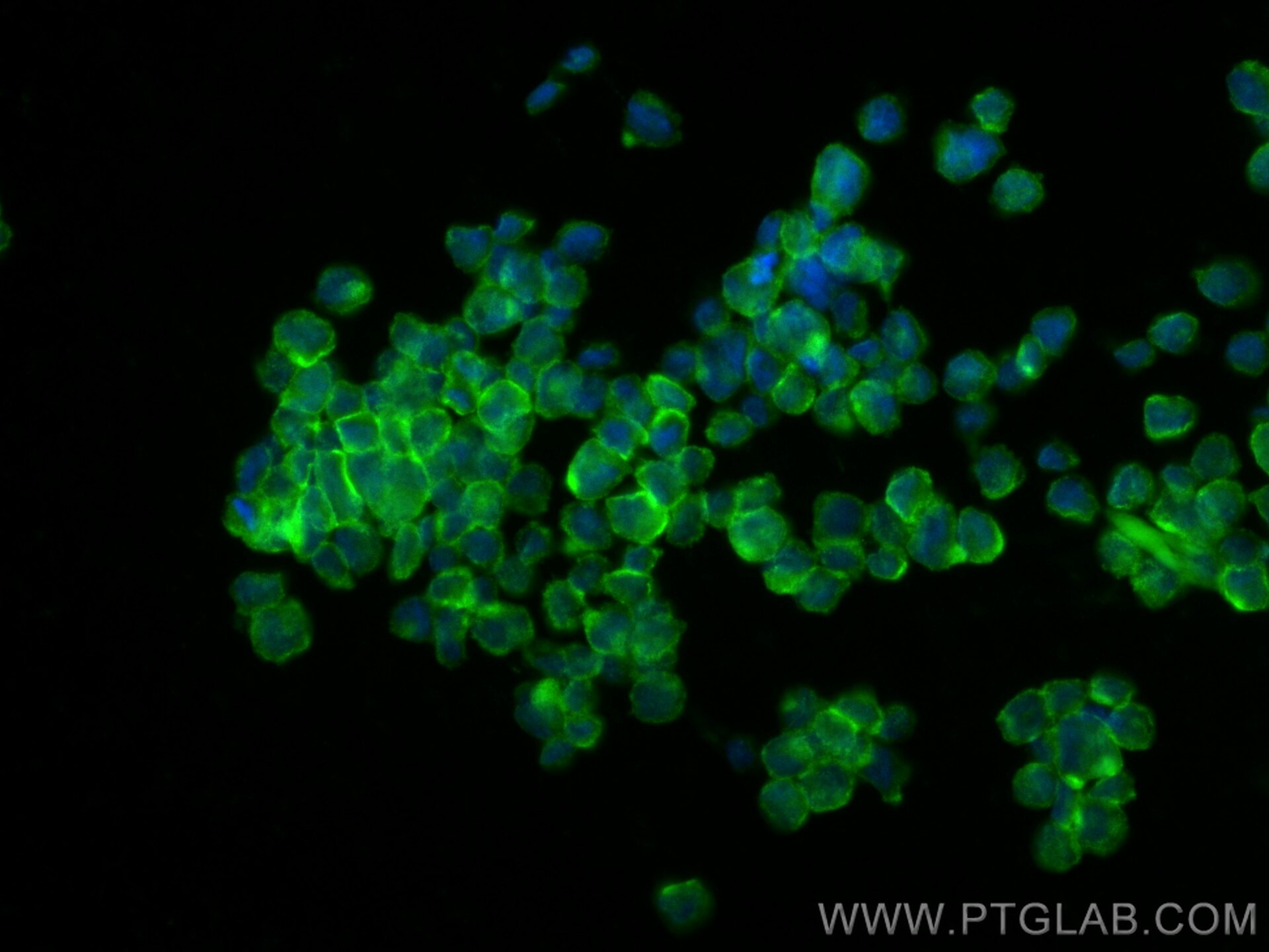 Immunofluorescence (IF) / fluorescent staining of THP-1 cells using MLC1 Polyclonal antibody (26038-1-AP)