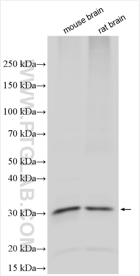MLC1