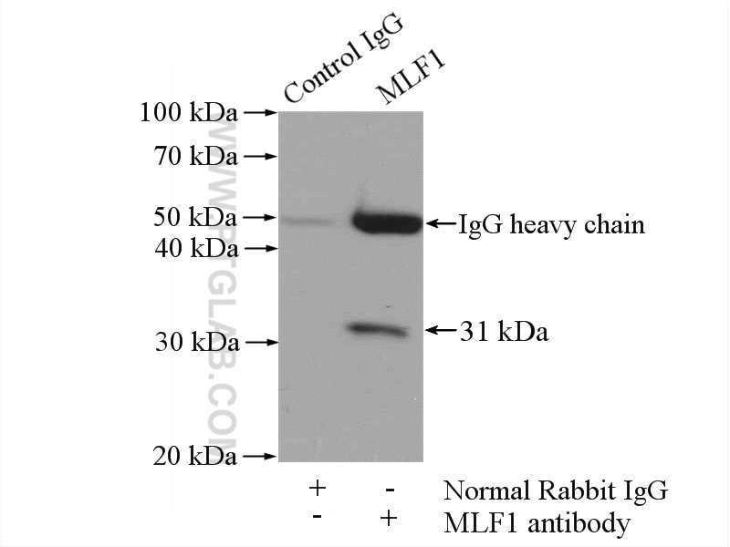 Immunoprecipitation (IP) experiment of mouse heart tissue using MLF1 Polyclonal antibody (13100-1-AP)