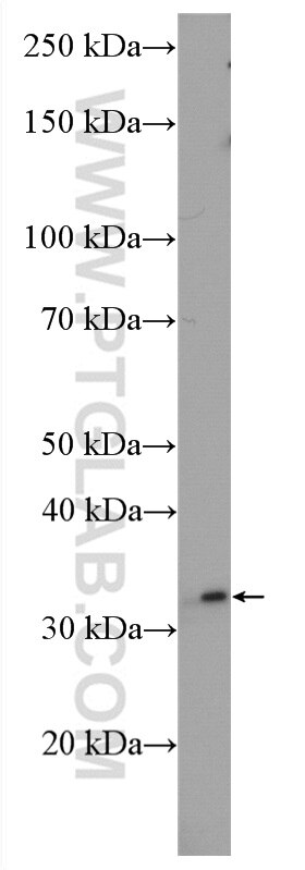 WB analysis of mouse testis using 13100-1-AP