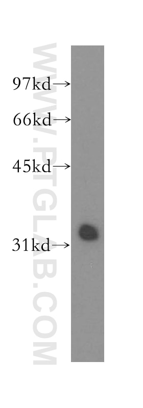 Western Blot (WB) analysis of mouse heart tissue using MLF1 Polyclonal antibody (13100-1-AP)