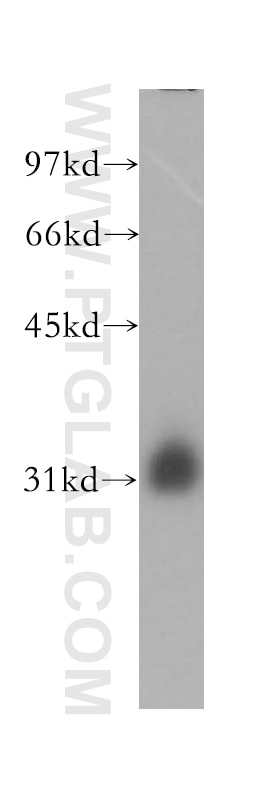 Western Blot (WB) analysis of human brain tissue using MLF1 Polyclonal antibody (13100-1-AP)