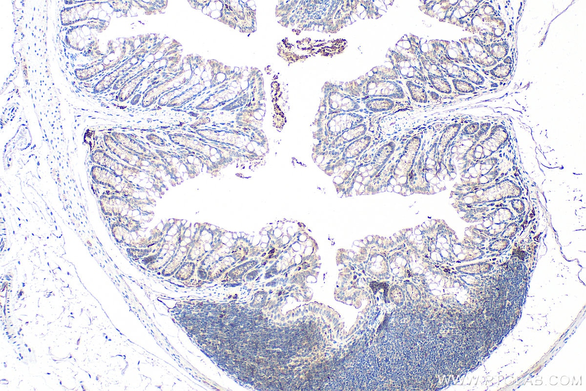 Immunohistochemistry (IHC) staining of mouse colon tissue using MLF1IP Polyclonal antibody (13186-1-AP)