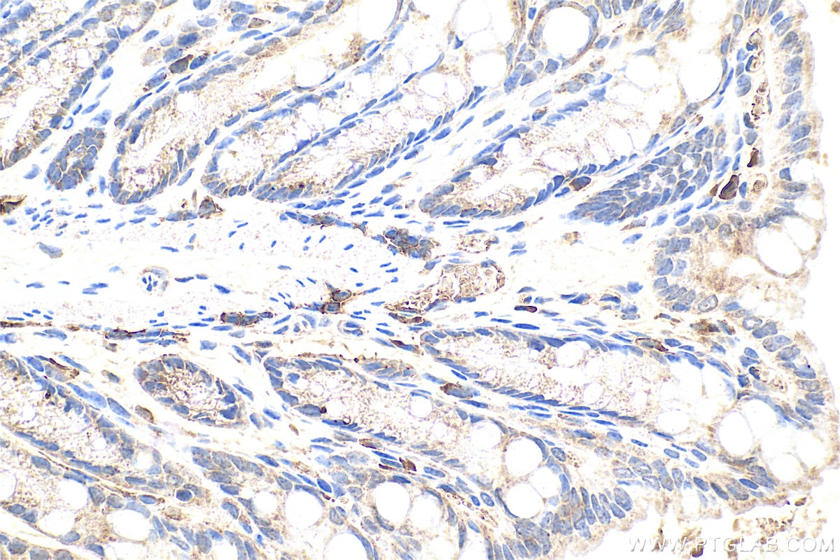 Immunohistochemistry (IHC) staining of mouse colon tissue using MLF1IP Polyclonal antibody (13186-1-AP)