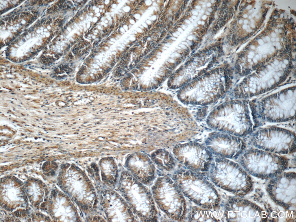 Immunohistochemistry (IHC) staining of human colon tissue using MLF1IP Polyclonal antibody (13186-1-AP)