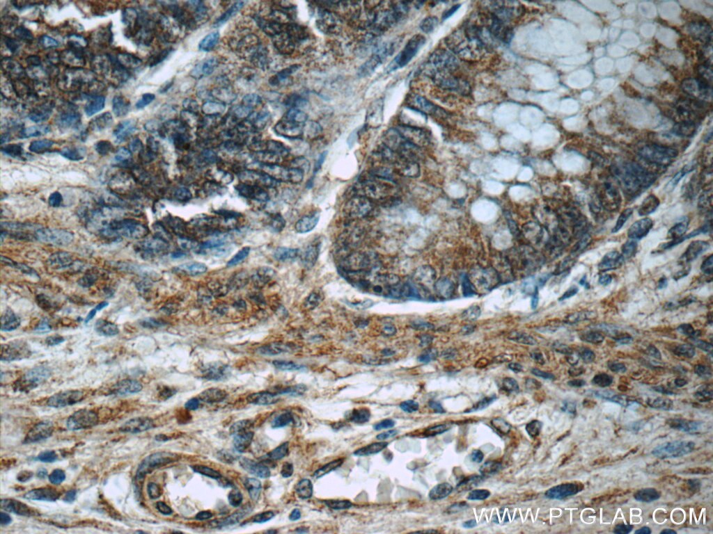 Immunohistochemistry (IHC) staining of human colon tissue using MLF1IP Polyclonal antibody (13186-1-AP)