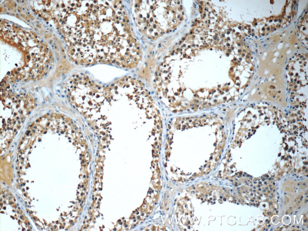 Immunohistochemistry (IHC) staining of human testis tissue using MLF1IP Polyclonal antibody (13186-1-AP)
