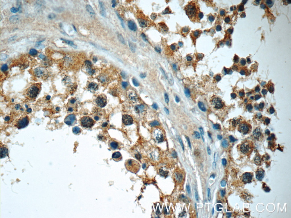 Immunohistochemistry (IHC) staining of human testis tissue using MLF1IP Polyclonal antibody (13186-1-AP)