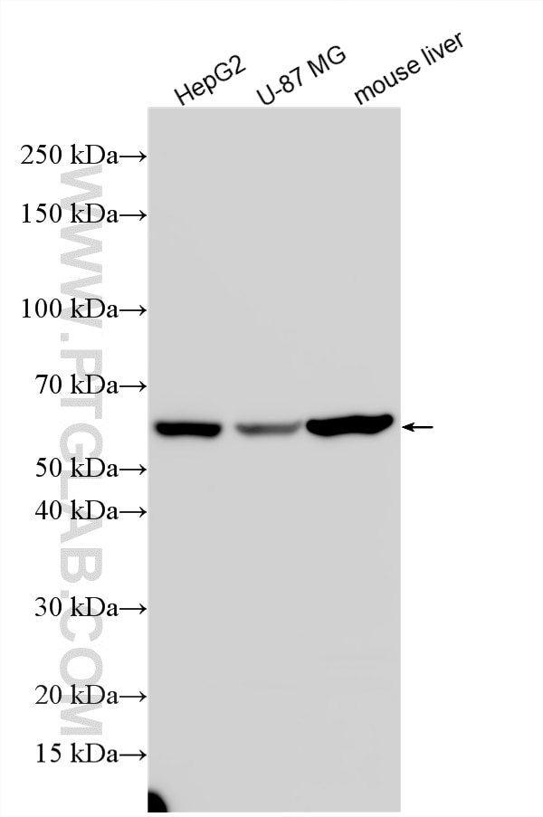 Western Blot (WB) analysis of various lysates using MLF1IP Polyclonal antibody (13186-1-AP)