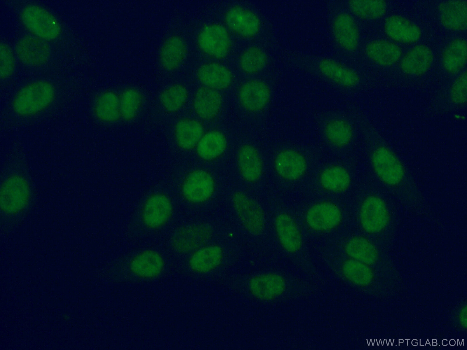 Immunofluorescence (IF) / fluorescent staining of HeLa cells using MLF2 Polyclonal antibody (11835-1-AP)