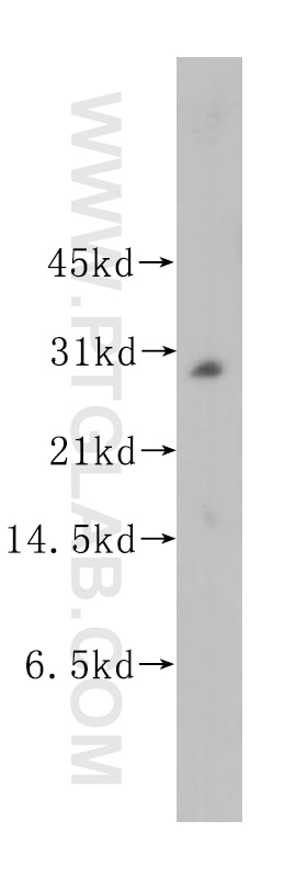 Western Blot (WB) analysis of human brain tissue using MLF2 Polyclonal antibody (11835-1-AP)