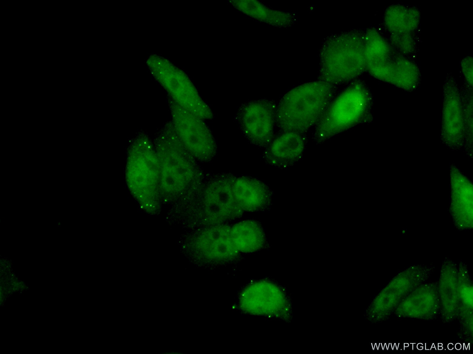 Immunofluorescence (IF) / fluorescent staining of HeLa cells using MLH1 Polyclonal antibody (11697-1-AP)