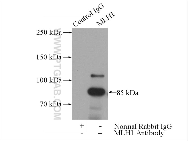 IP experiment of HeLa using 11697-1-AP