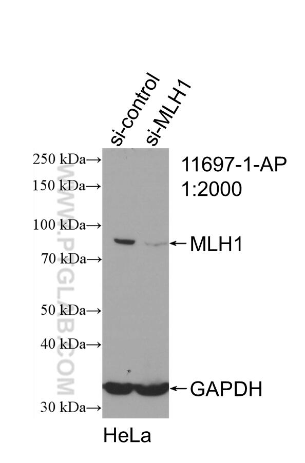 Western Blot (WB) analysis of HeLa cells using MLH1 Polyclonal antibody (11697-1-AP)