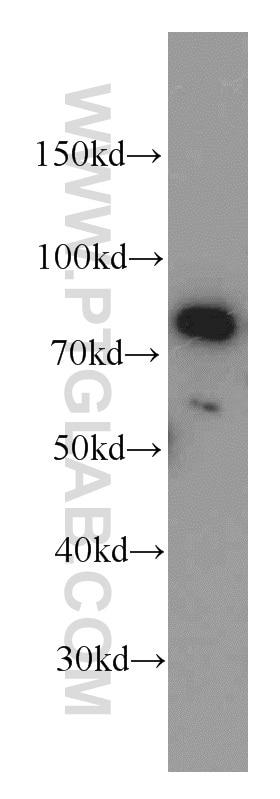 Western Blot (WB) analysis of HeLa cells using MLH1 Polyclonal antibody (11697-1-AP)