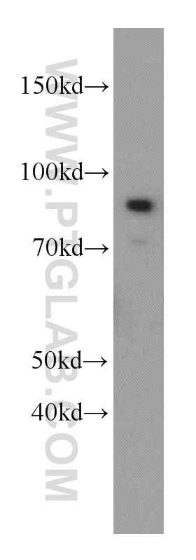 Western Blot (WB) analysis of Jurkat cells using MLH1 Polyclonal antibody (11697-1-AP)