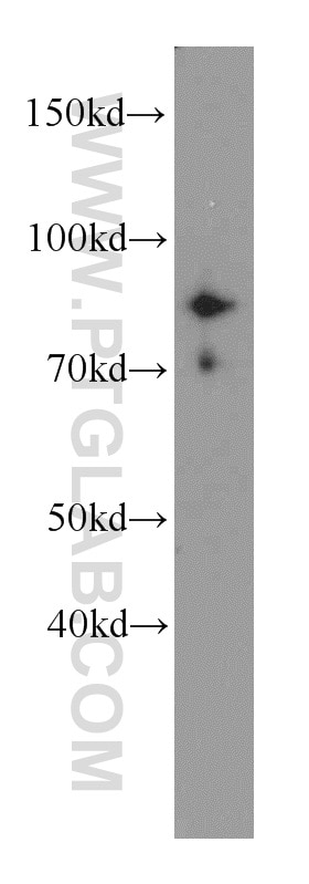 Western Blot (WB) analysis of human testis tissue using MLH1 Polyclonal antibody (11697-1-AP)