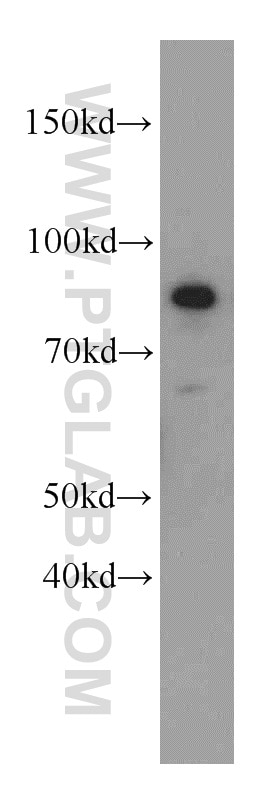Western Blot (WB) analysis of A431 cells using MLH1 Polyclonal antibody (11697-1-AP)