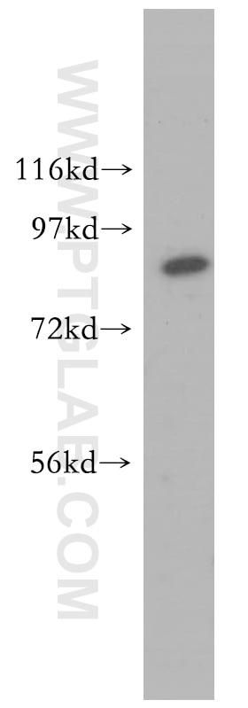 Western Blot (WB) analysis of HEK-293 cells using MLH1 Polyclonal antibody (11697-1-AP)