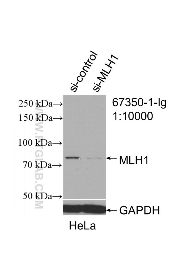 Western Blot (WB) analysis of HeLa cells using MLH1 Monoclonal antibody (67350-1-Ig)