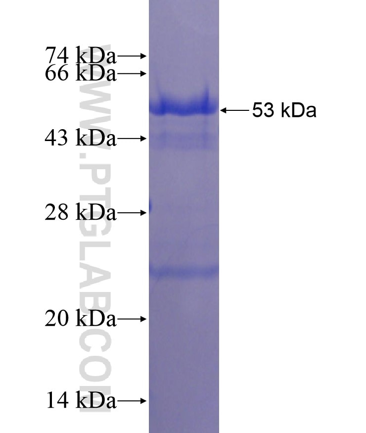 MLH3 fusion protein Ag18201 SDS-PAGE