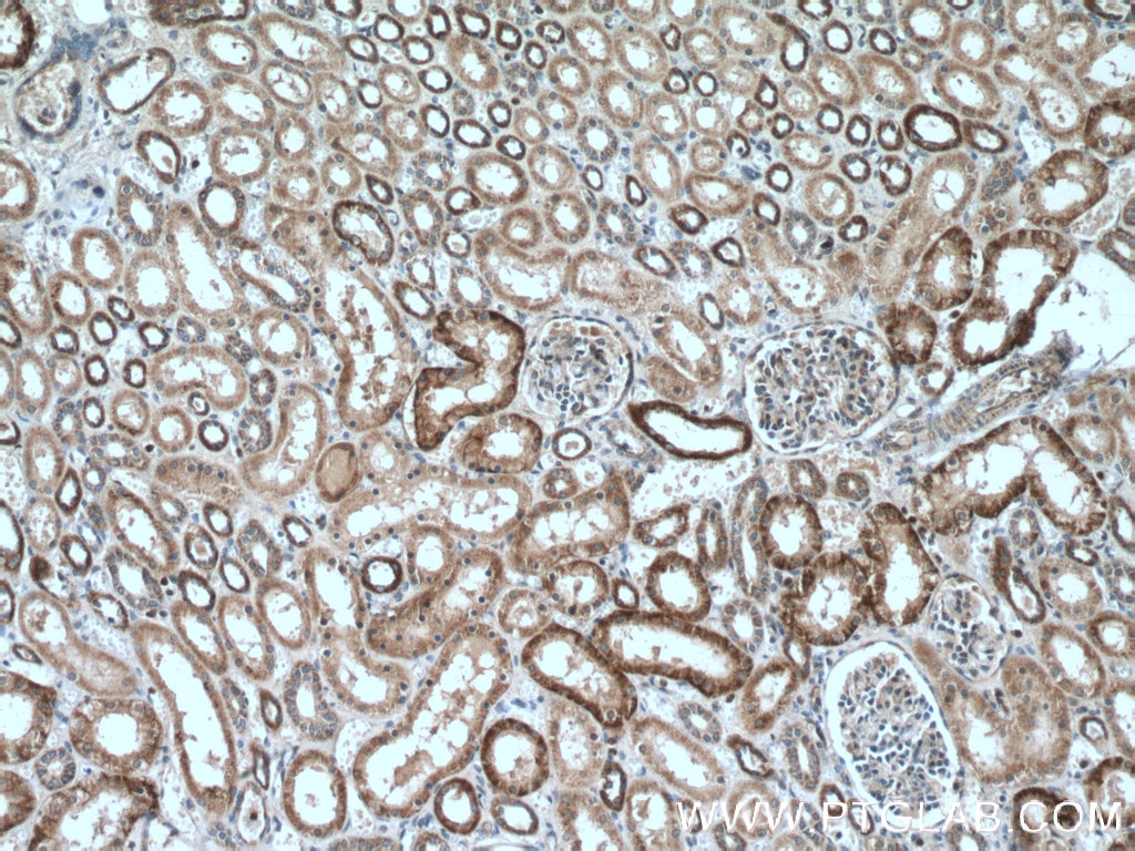 Immunohistochemistry (IHC) staining of human kidney tissue using MLKL Polyclonal antibody (21066-1-AP)