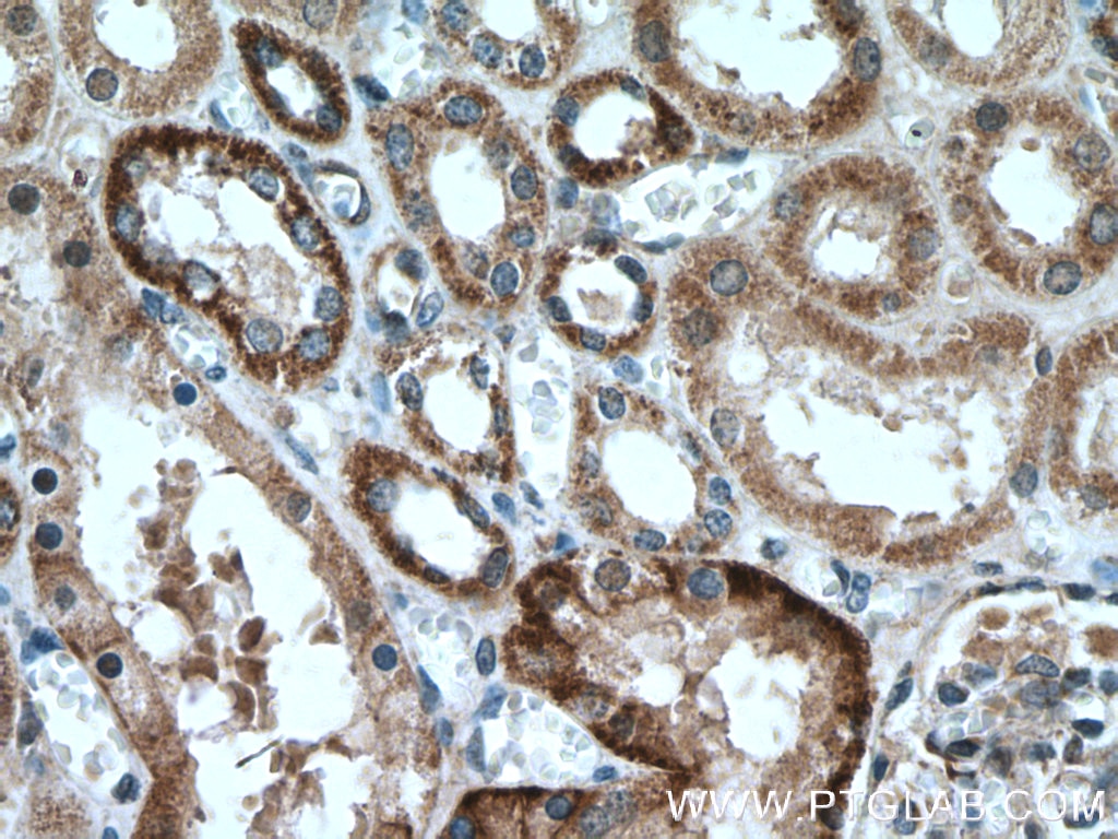 Immunohistochemistry (IHC) staining of human kidney tissue using MLKL Polyclonal antibody (21066-1-AP)