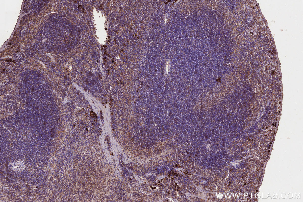 IHC staining of mouse spleen using 66675-1-Ig Immunohistochemistry (IHC) staining of mouse spleen tissue using MLKL Monoclonal antibody (66675-1-Ig)