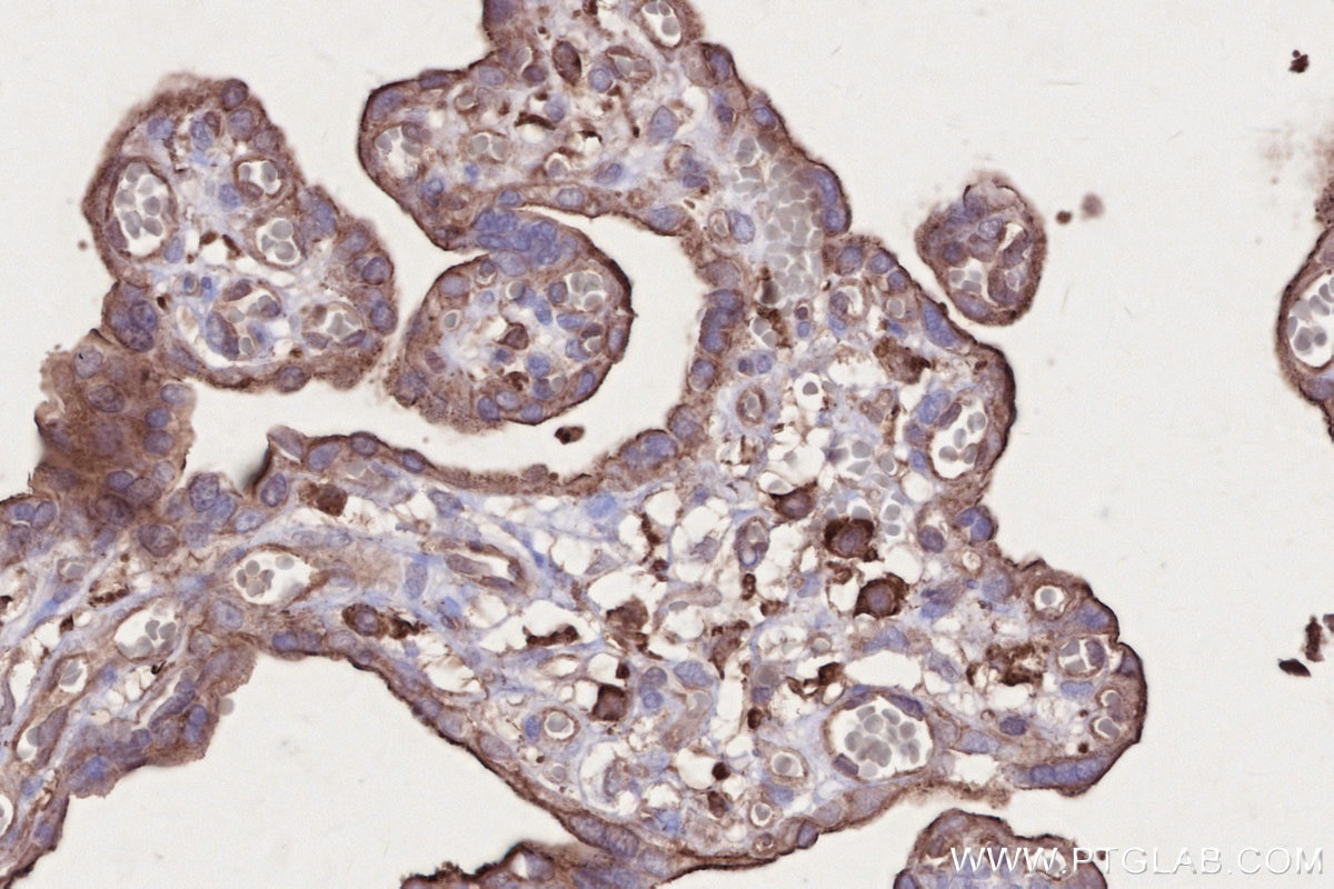 IHC staining of human placenta using 66675-1-Ig Immunohistochemistry (IHC) staining of human placenta tissue using MLKL Monoclonal antibody (66675-1-Ig)