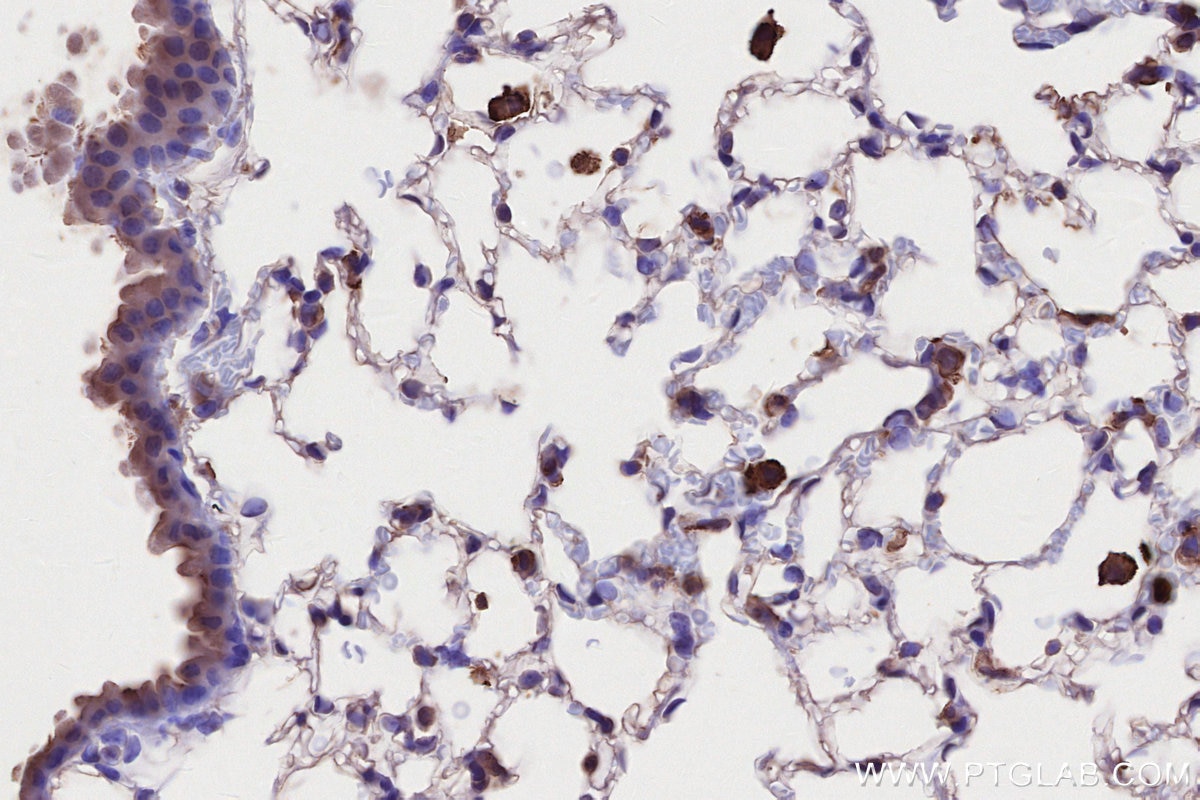IHC staining of mouse lung using 66675-1-Ig Immunohistochemistry (IHC) staining of mouse lung tissue using MLKL Monoclonal antibody (66675-1-Ig)