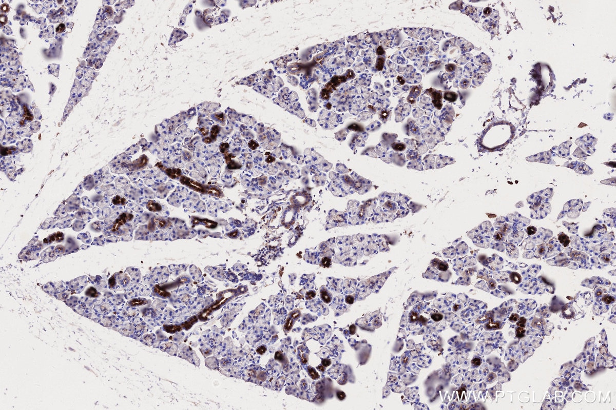IHC staining of mouse salivary gland using 66675-1-Ig Immunohistochemistry (IHC) staining of mouse salivary gland tissue using MLKL Monoclonal antibody (66675-1-Ig)
