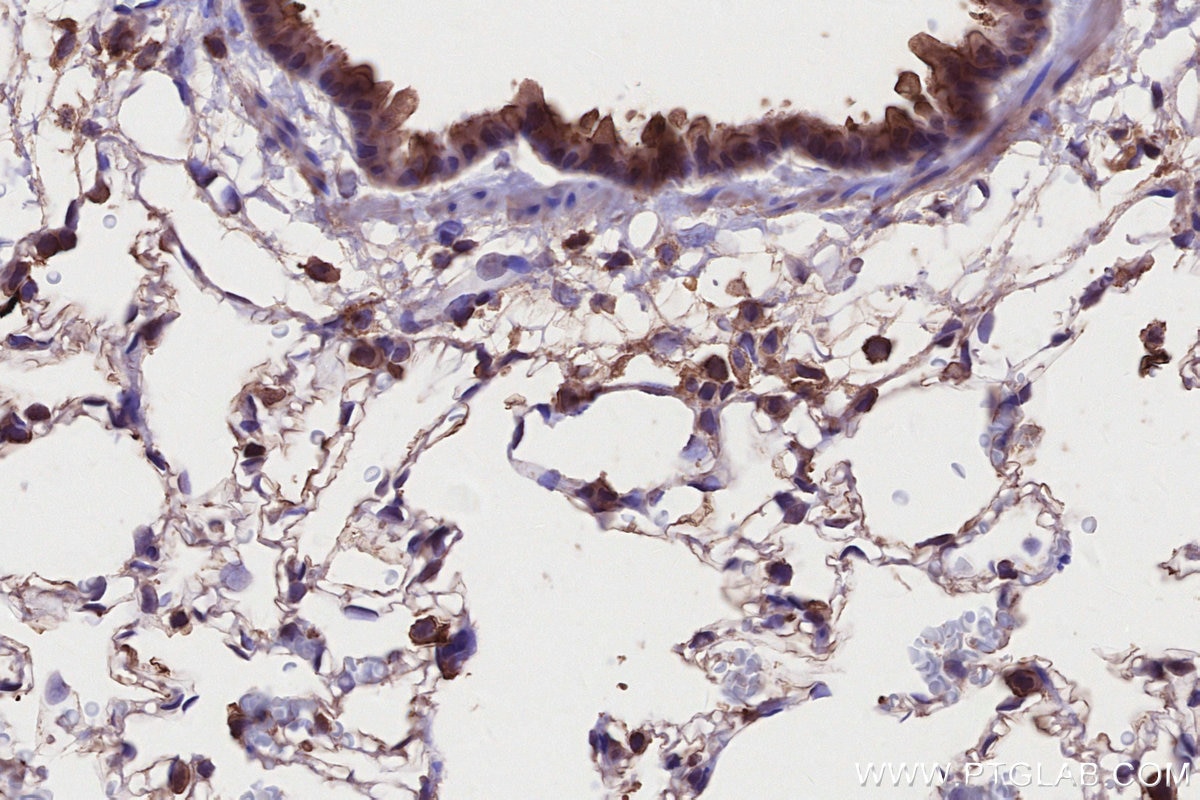 IHC staining of rat lung using 66675-1-Ig Immunohistochemistry (IHC) staining of rat lung tissue using MLKL Monoclonal antibody (66675-1-Ig)