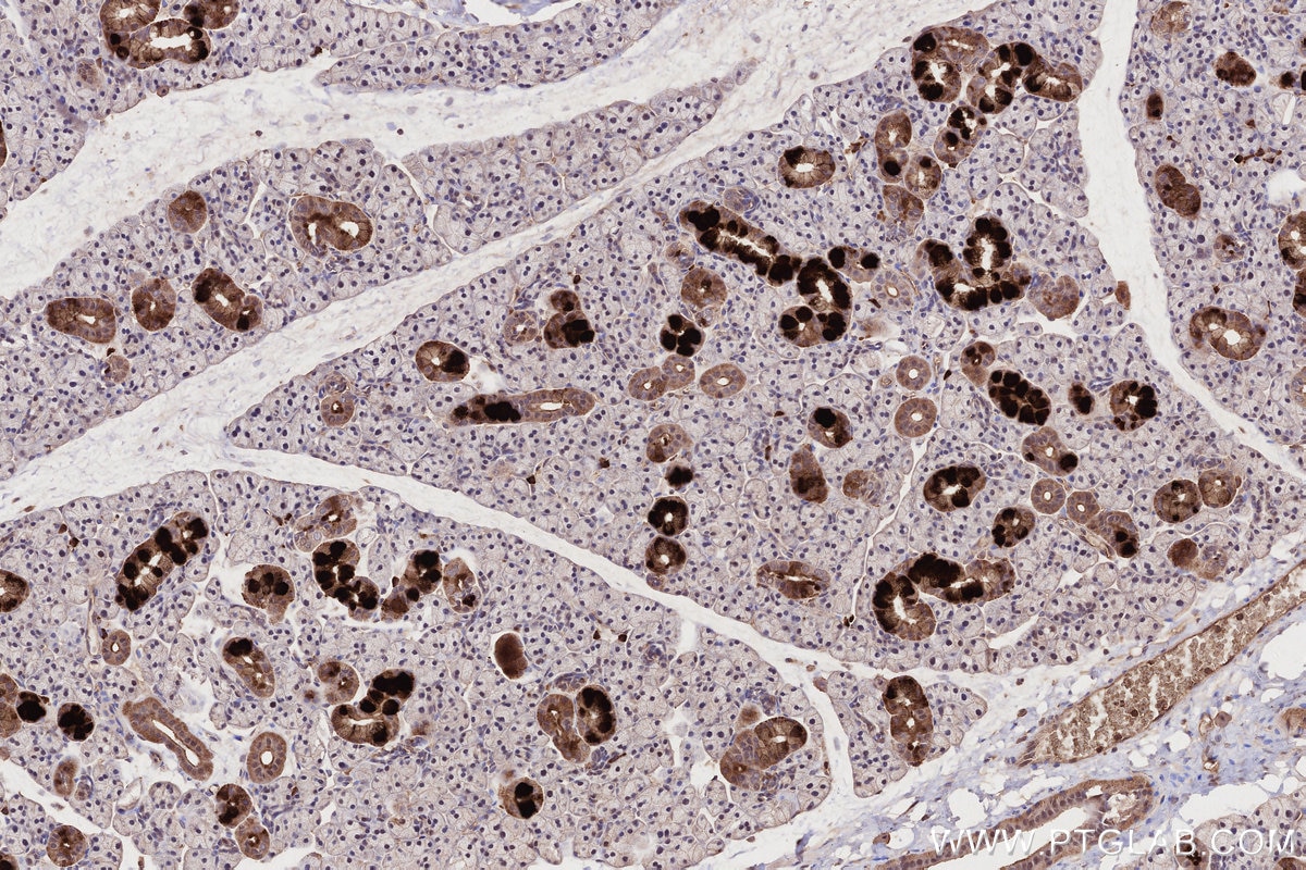 IHC staining of rat salivary gland using 66675-1-Ig Immunohistochemistry (IHC) staining of rat salivary gland tissue using MLKL Monoclonal antibody (66675-1-Ig)